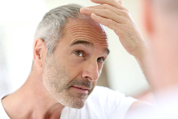 Where can get the best Hair Transplant treatment in Ludhiana?