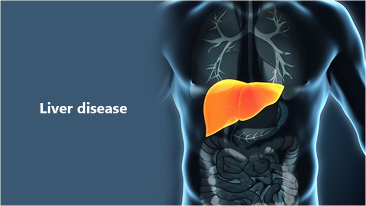 What are liver failure and the Causes of liver failure?