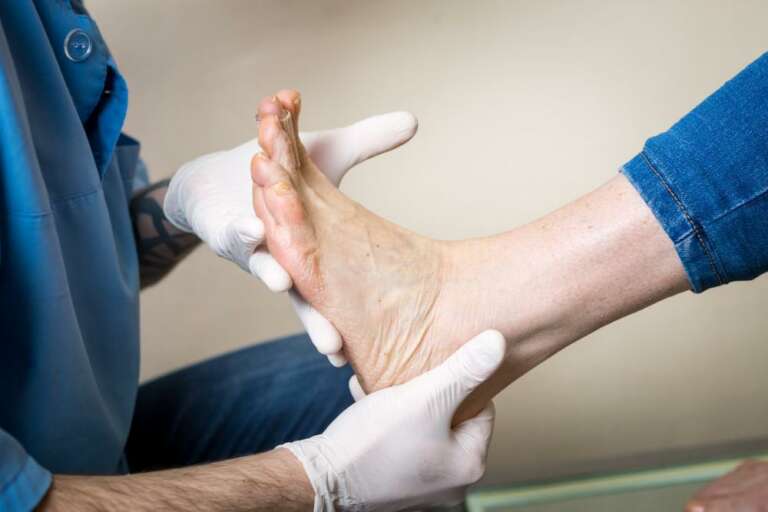 Ankle Injuries: what to do?
