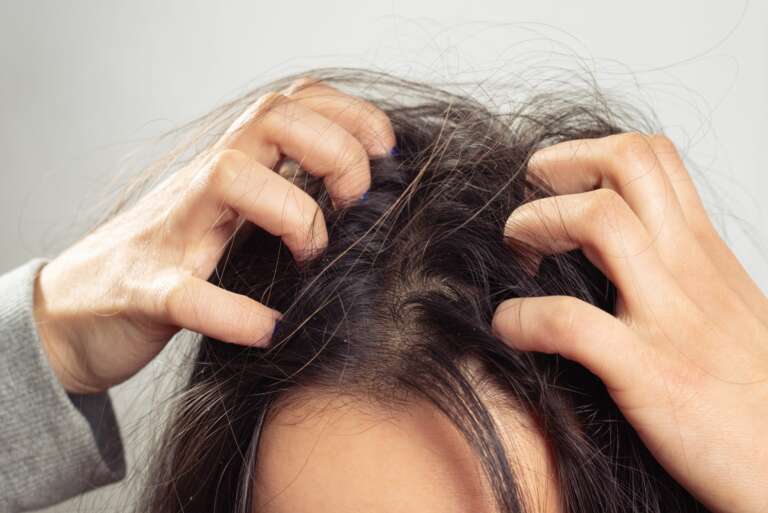 What is the reason behind that scalp itch?