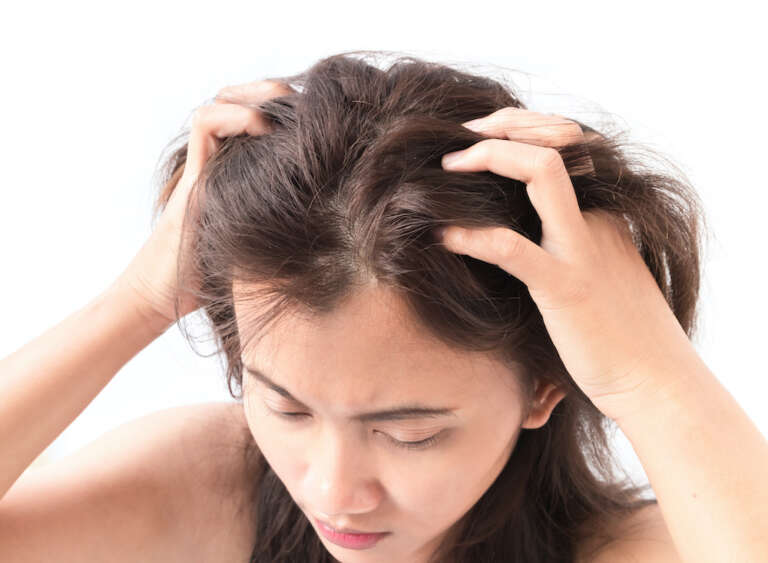 Explore the Various Causes of Itchy Scalps